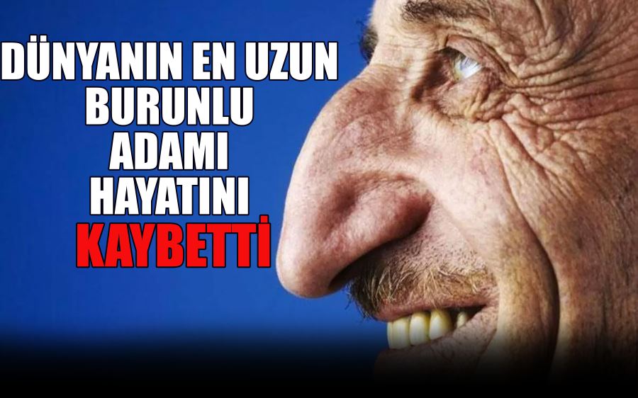 DÜNYANIN EN UZUN  BURUNLU ADAMI  HAYATINI KAYBETTİ