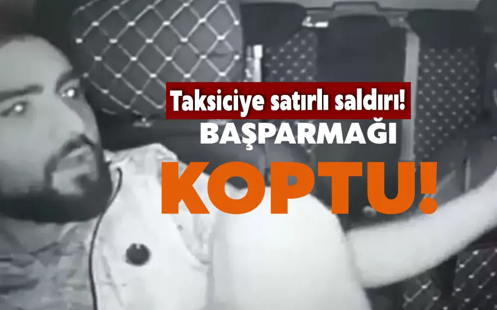 TAKSİCİYE SATIRLI SALDIRI! BAŞPARMAĞI KOPTU!