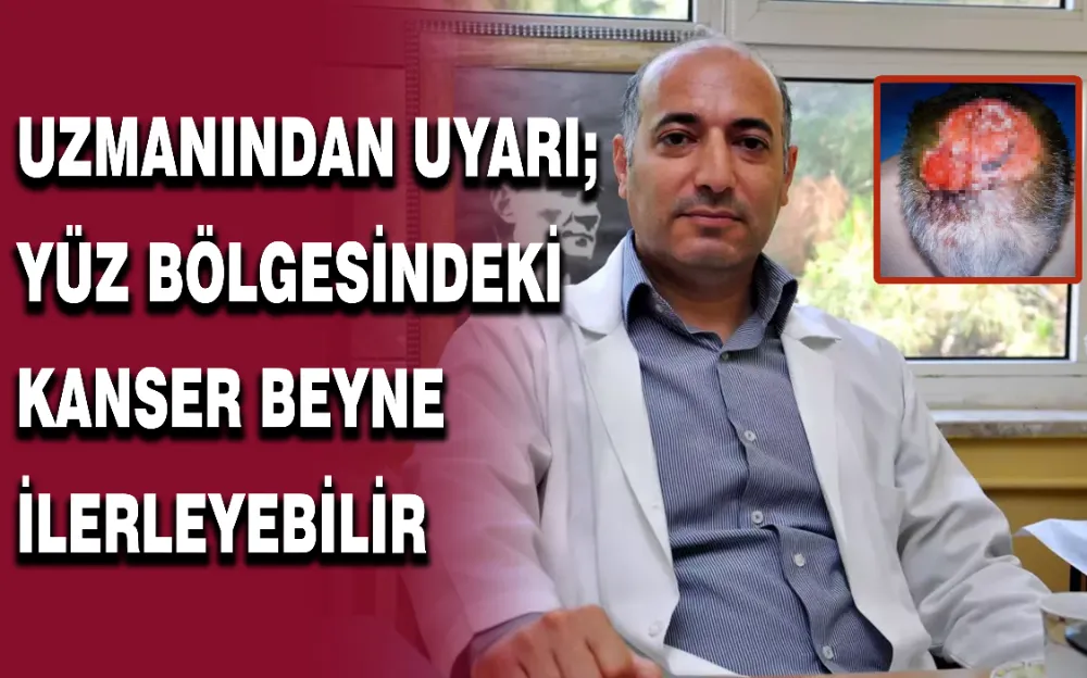  UZMANINDAN UYARI; YÜZ BÖLGESİNDEKİ KANSER BEYNE İLERLEYEBİLİR!